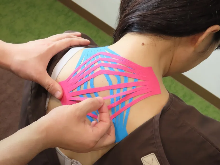 キネシオテーピング療法